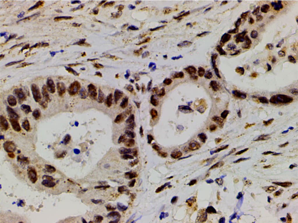 LIMK1 / LIMK Antibody (phospho-Thr508)