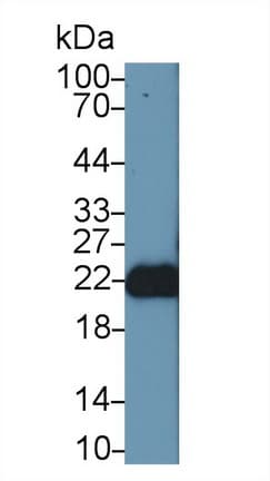 FGF12 Antibody (aa1-181, Biotin)