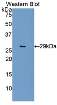IGF2R / CD222 Antibody (aa1148-1365)