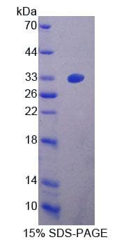Mouse DNAJC2 / ZRF1 Protein (Recombinant His-T7)