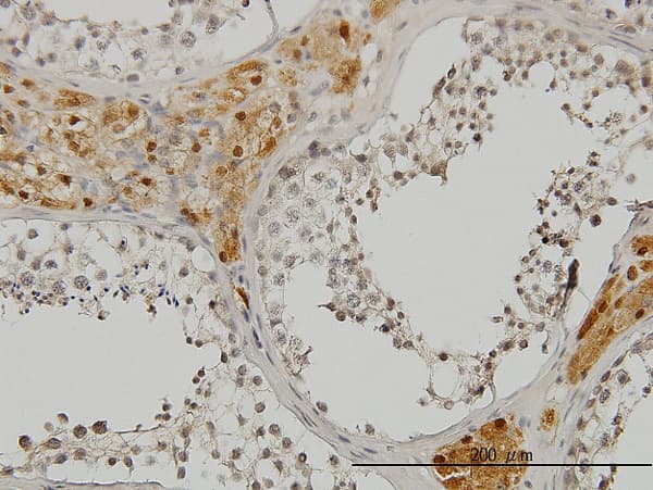 CREB3 / LZIP Antibody (clone 3H5)