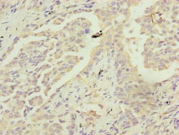 Polyclonal Rabbit anti-Human MRPS22 Antibody (IHC)