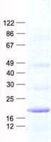 Human SPC18 / SEC11A Protein (Recombinant His, N-Terminal)