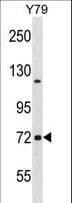 Polyclonal Rabbit anti-Human Neurochondrin Antibody (aa114-144, WB)