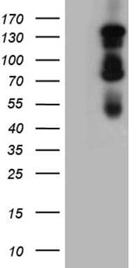 Monoclonal Mouse anti-Human GLI / GLI1 Antibody (clone OTI2B3, aa755-1106, WB)
