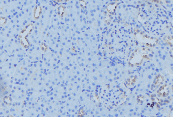 Polyclonal Rabbit anti-Human NDUFB7 / B18 Antibody (IHC, WB)