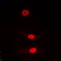 PLK1 / PLK-1 Antibody (Internal)