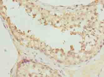 Polyclonal Rabbit anti-Human FAM113A Antibody (IHC)