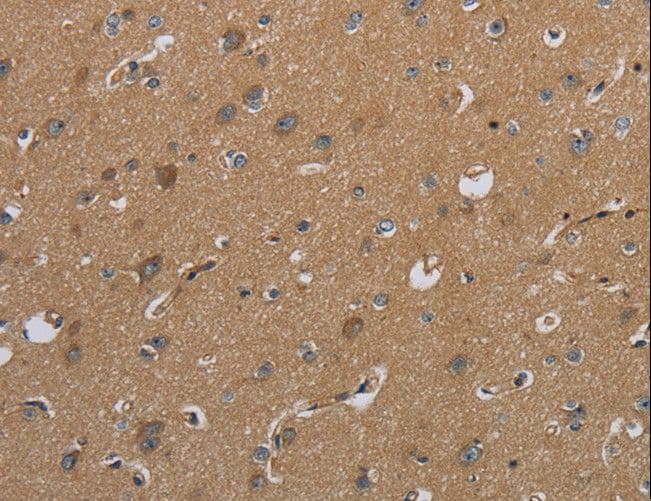 CSH1 / Placental Lactogen Antibody