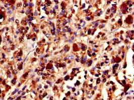 XRCC5 / Ku80 Antibody