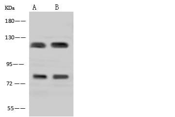 ADAP / FYB Antibody