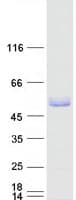 Human TRIM15 Protein (Recombinant Myc-DDK (Flag))