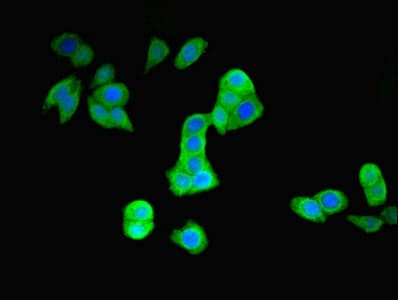 Polyclonal Rabbit anti-Human PARK2 / Parkin 2 Antibody (aa1-465)