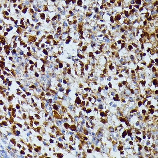 Polyclonal Rabbit anti-Human DUT / DUTPase Antibody (IHC, IF, WB)