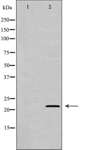 AK1 / Adenylate Kinase 1 Antibody