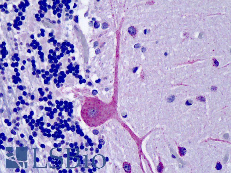 IHC-plus™ OSBPL1A / ORP1 Antibody (aa938-950)