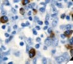 Monoclonal Mouse anti-Human CD7 Antibody (clone LP15, IHC)