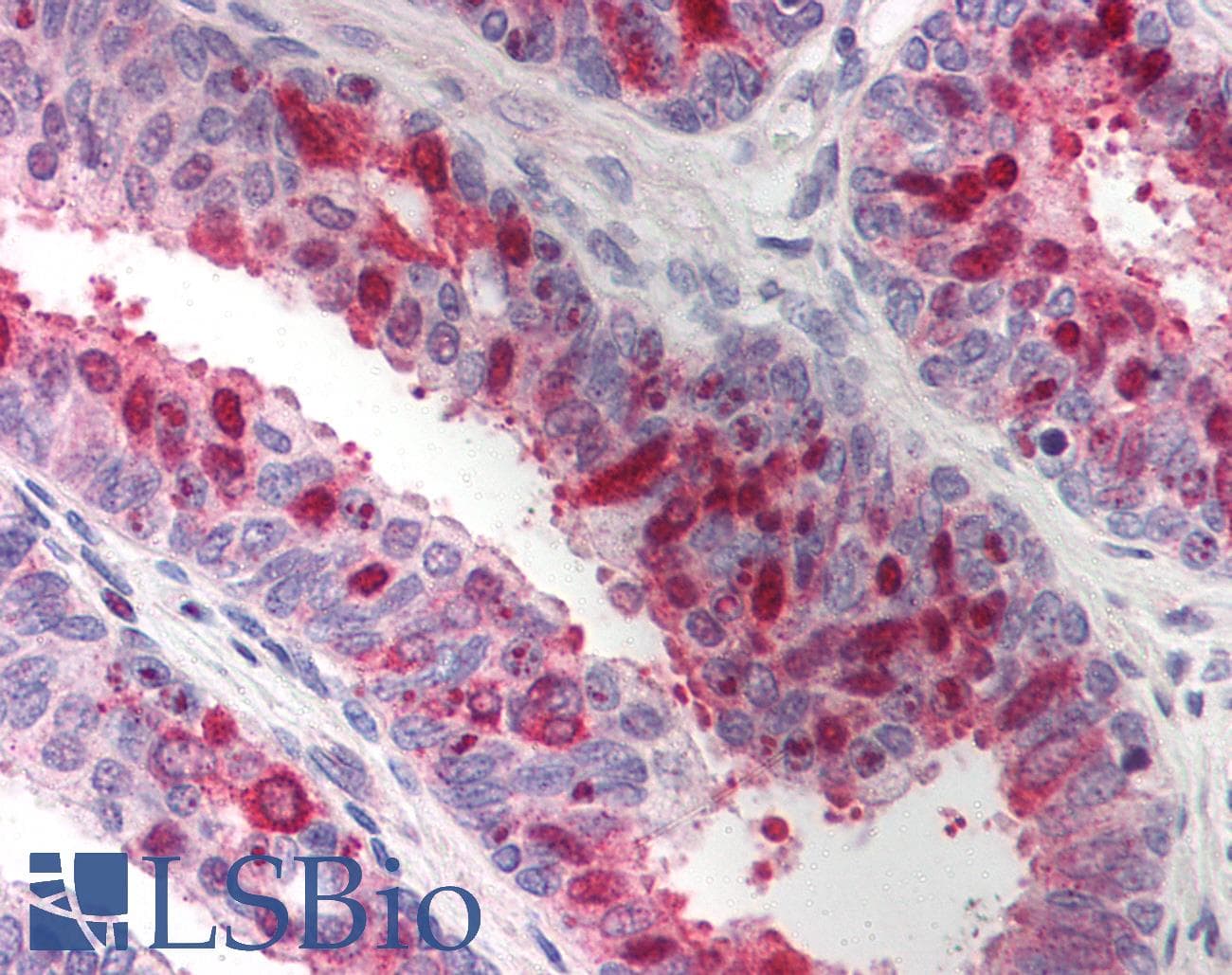 IHC-plus™ XAF1 Antibody