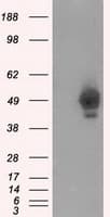 PRKAR2A Antibody (clone OTI1B4)