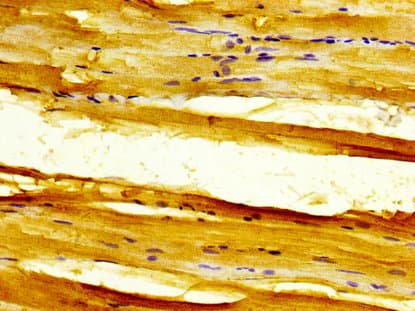 Polyclonal Rabbit anti-Human SLC11A1 / NRAMP Antibody (IHC, WB)