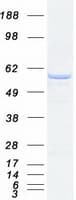 Human PPP2R5B Protein (Recombinant Myc-DDK (Flag))