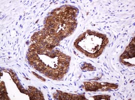 EMA / MUC1 Antibody (clone OTI2E3)
