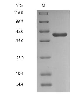 Human GAPDHS / GAPDS Protein (Recombinant 6His, N-terminus)
