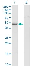 CKM / Creatine Kinase MM Antibody (clone 3E1-F3)