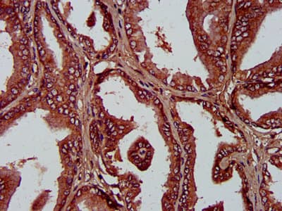 PSPLA1 / Phospholipase A1 Antibody