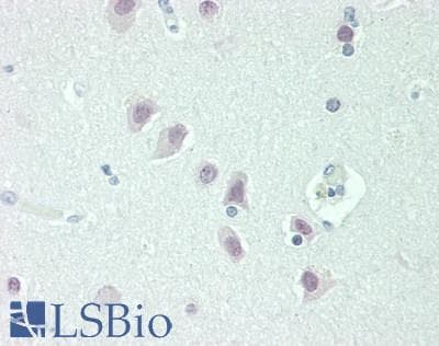 IHC-plus™ NOVA1 Antibody (C-Terminus)