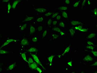 PRMT7 Antibody