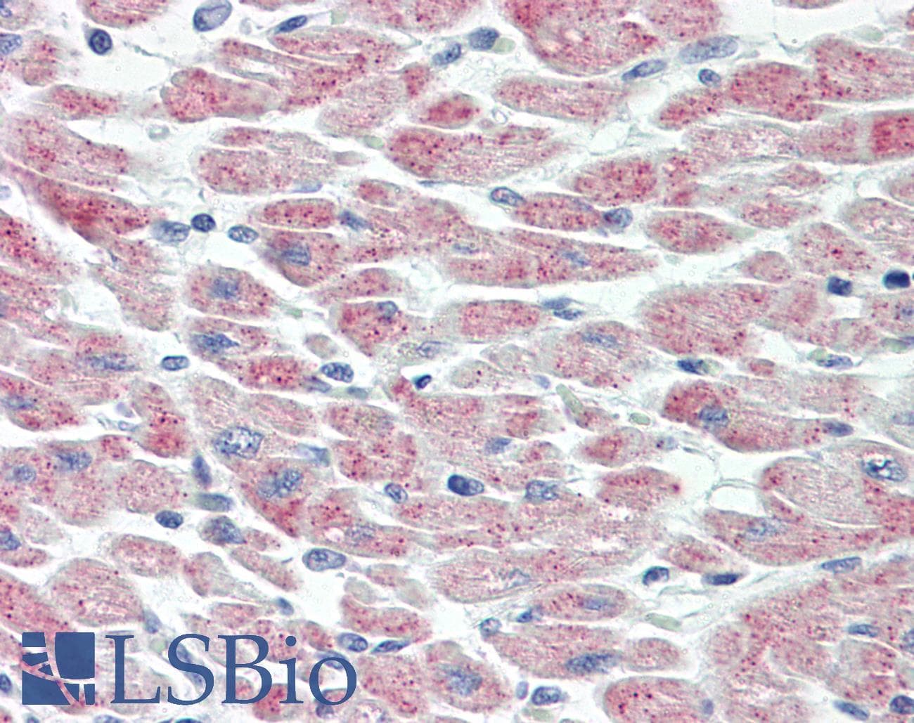 IHC-plus™ Polyclonal Rabbit anti-Human USP19 Antibody (aa391-440, IHC, WB)