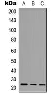 NCALD / Neurocalcin Delta Antibody (Internal)