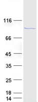 Human DDX21 Protein (Recombinant Myc-DDK (Flag))