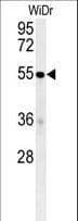 IHC-plus™ C4BPA / C4BP Alpha Antibody (aa470-499)