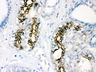 SOD2 / Mn SOD Antibody