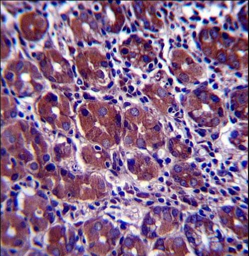 Polyclonal Rabbit anti-Human GOPC / PIST Antibody (aa357-386, IHC, WB)