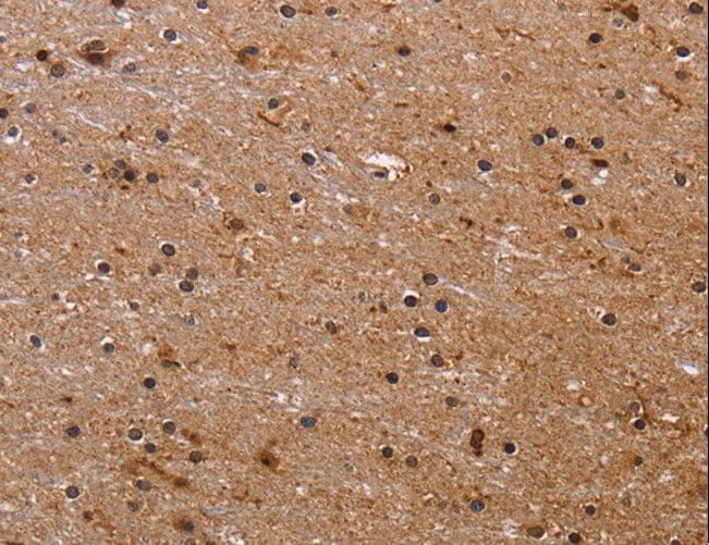 Polyclonal Rabbit anti-Human FBP2 Antibody (IHC)
