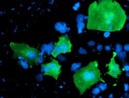 LIMK1 / LIMK Antibody (clone OTI8B2, Carrier-free)
