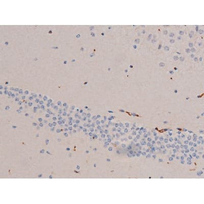 Polyclonal Rabbit anti-Human CDC25A Antibody (phospho-Ser124, IHC, IF, WB)