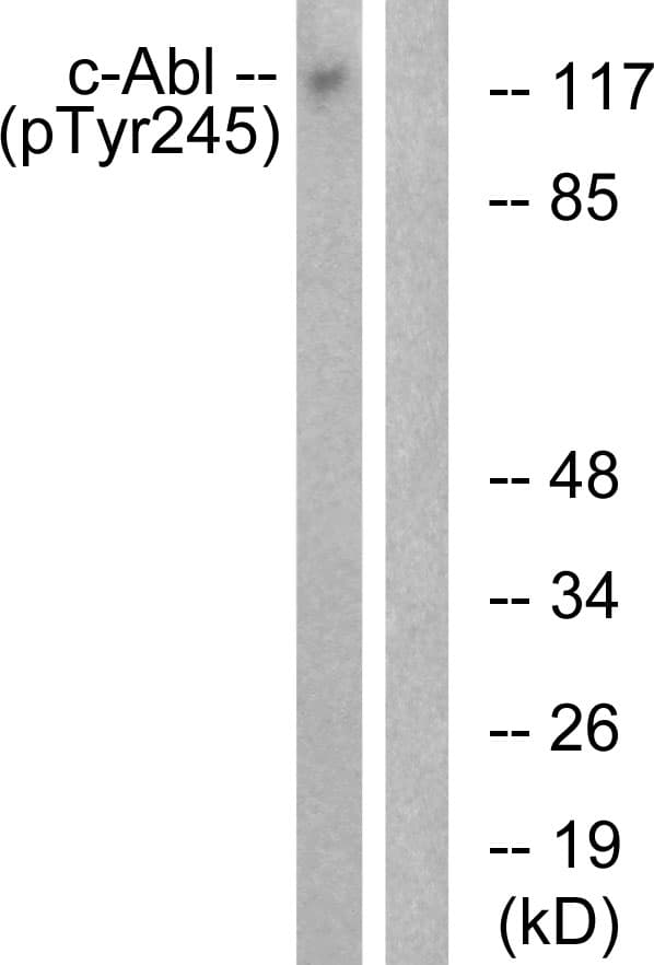 ABL1 / c-ABL Antibody (phospho-Tyr245)