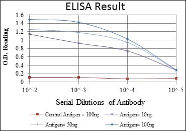 IHC-plus™ ACTA2 / Smooth Muscle Actin Antibody (clone 1H8)