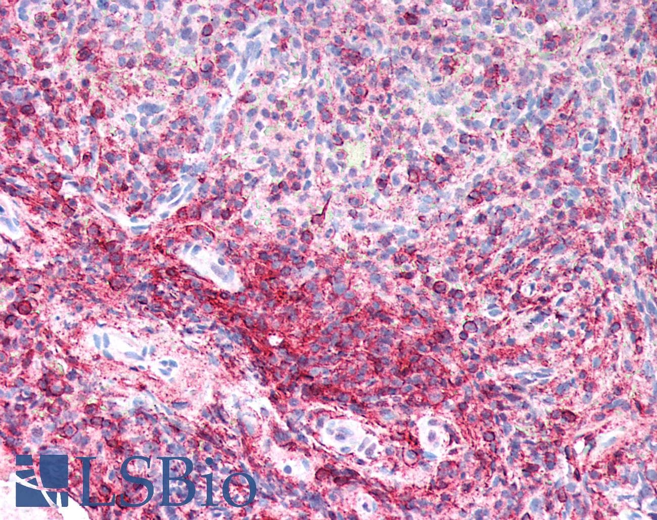 IHC-plus™ CD44 Antibody (clone ABT-CD44)