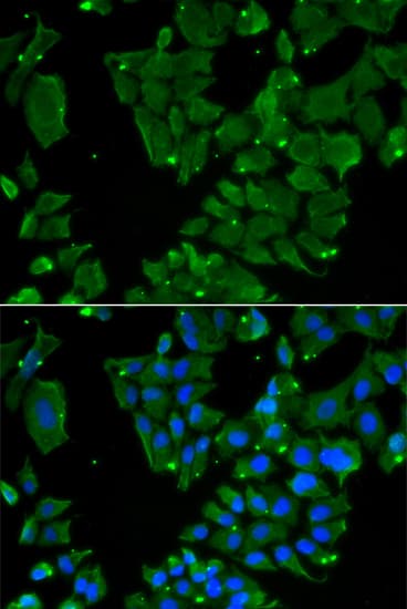 DBN1 / Drebrin Antibody