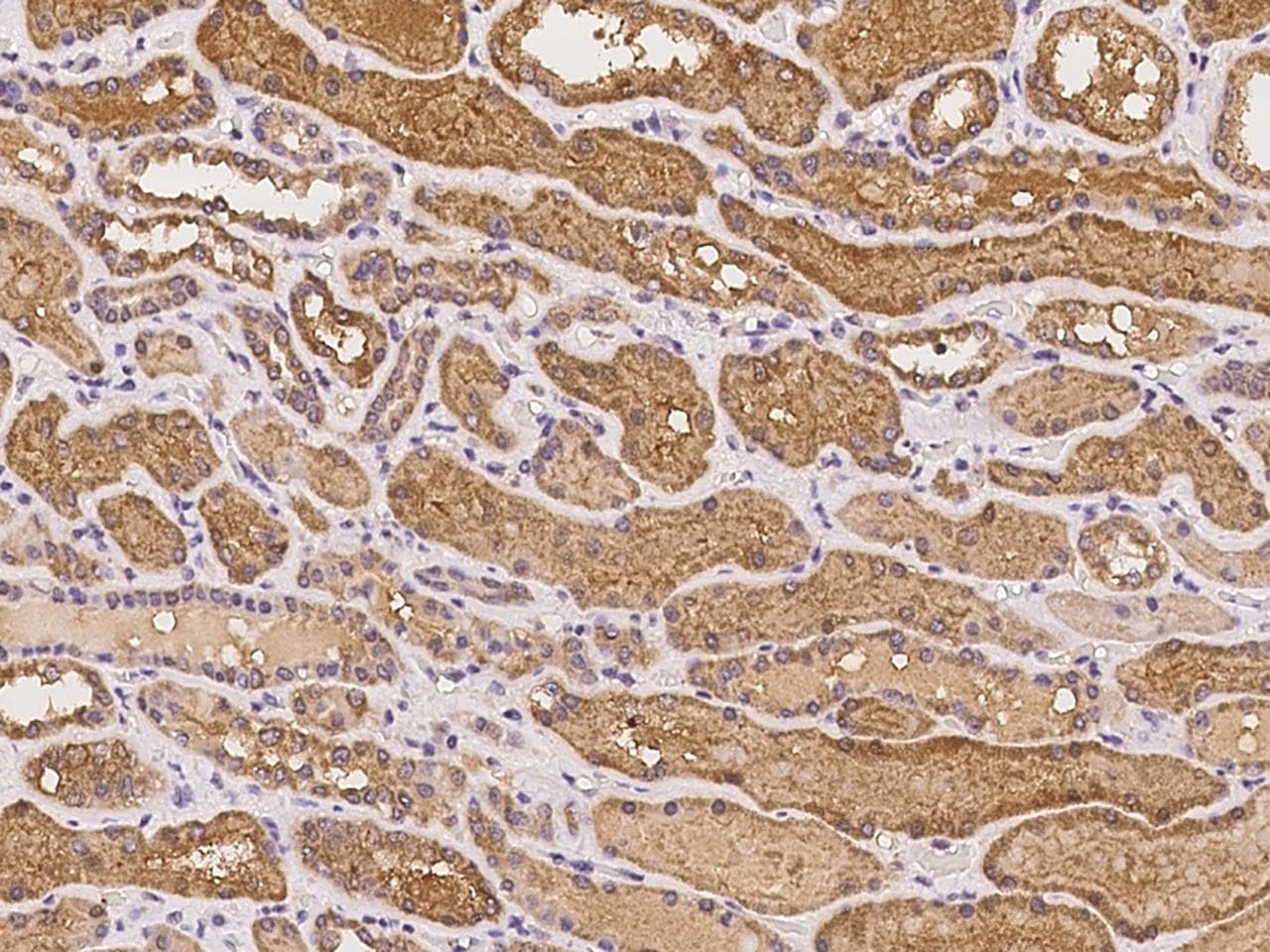 PDLIM4 / RIL Antibody