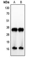 IL4 Antibody (Internal)