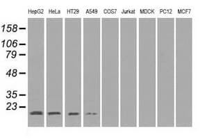 IHC-plus™ SOD1 / Cu-Zn SOD Antibody (clone 8B10)