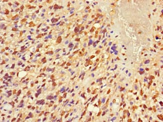 FRMD5 Antibody