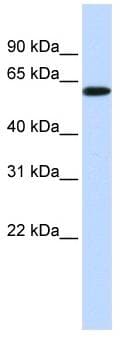 SH3BP2 Antibody (aa432-481)