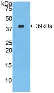 Mouse Nesfatin-1 Protein (Recombinant His-GST, N-terminus)
